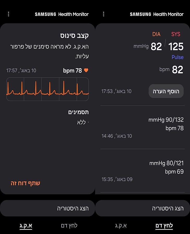 ניטור לחץ דם וקצב סינוס לזיהוי פרפור פרוזדורים